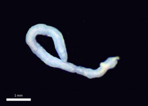 Annélide Phallodrilinae sp. (photo M. delangle, dét. M. Creuzé des Châteliers)